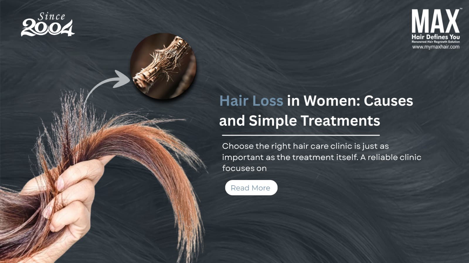 hair loss treatment in delhi