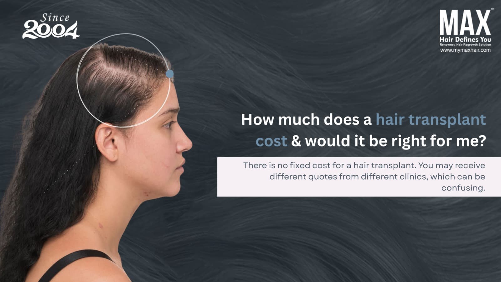 hair transplant cost in Coimbatore