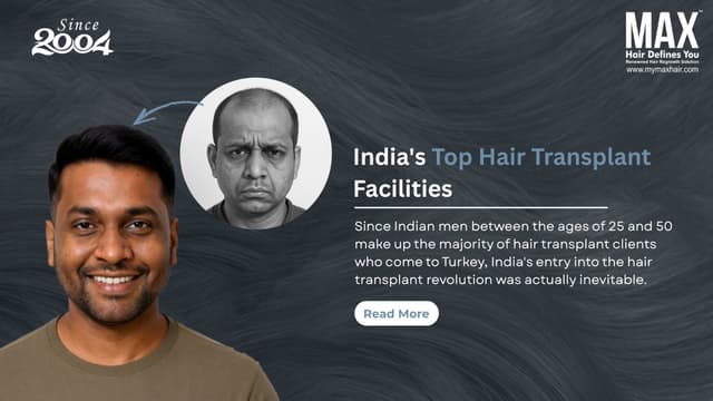 India's Top Hair Transplant Facilities Image