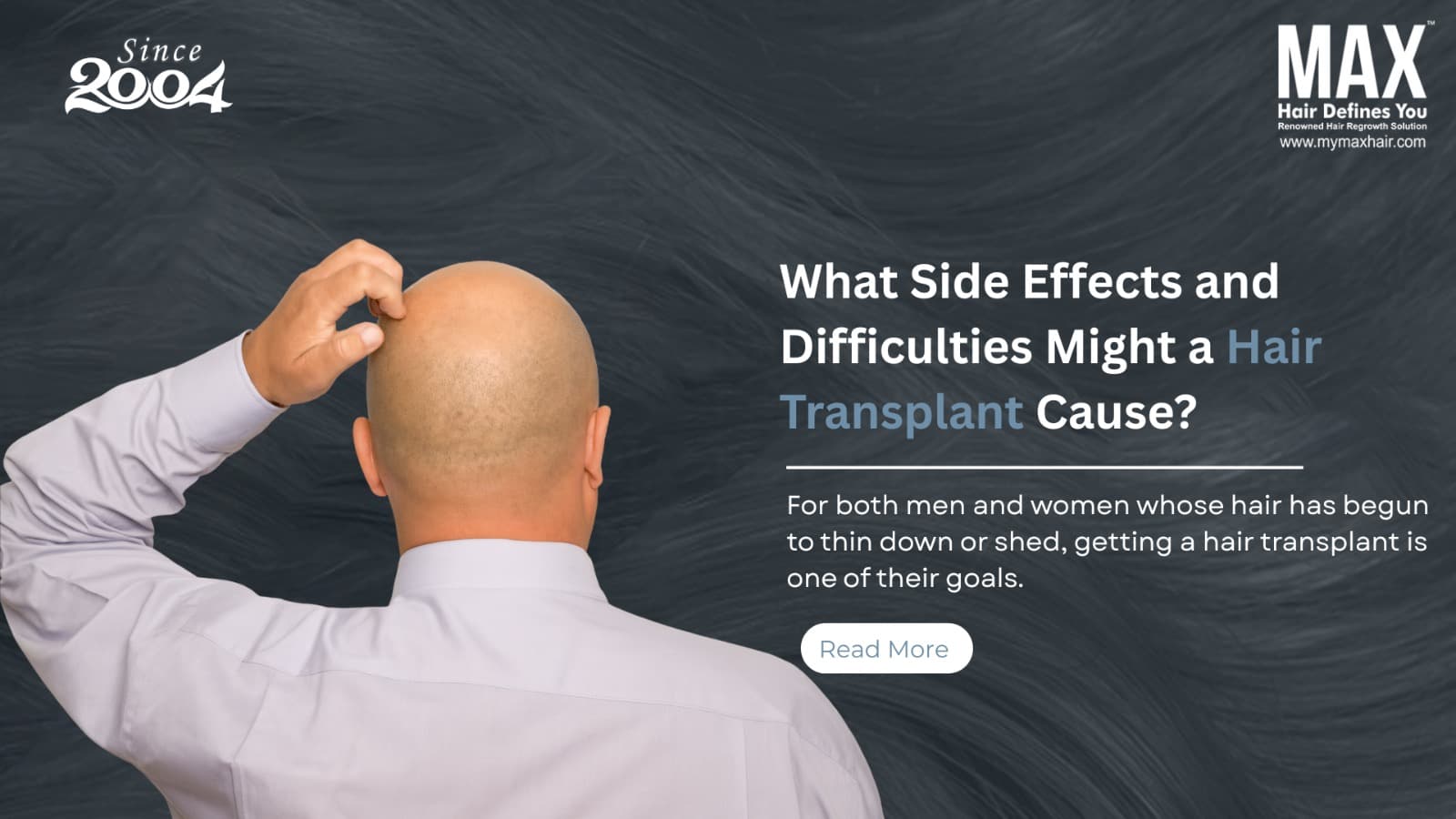 hair transplant Clinic in chennai