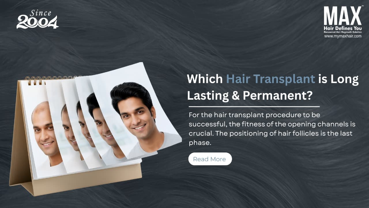 hair transplant in chennai