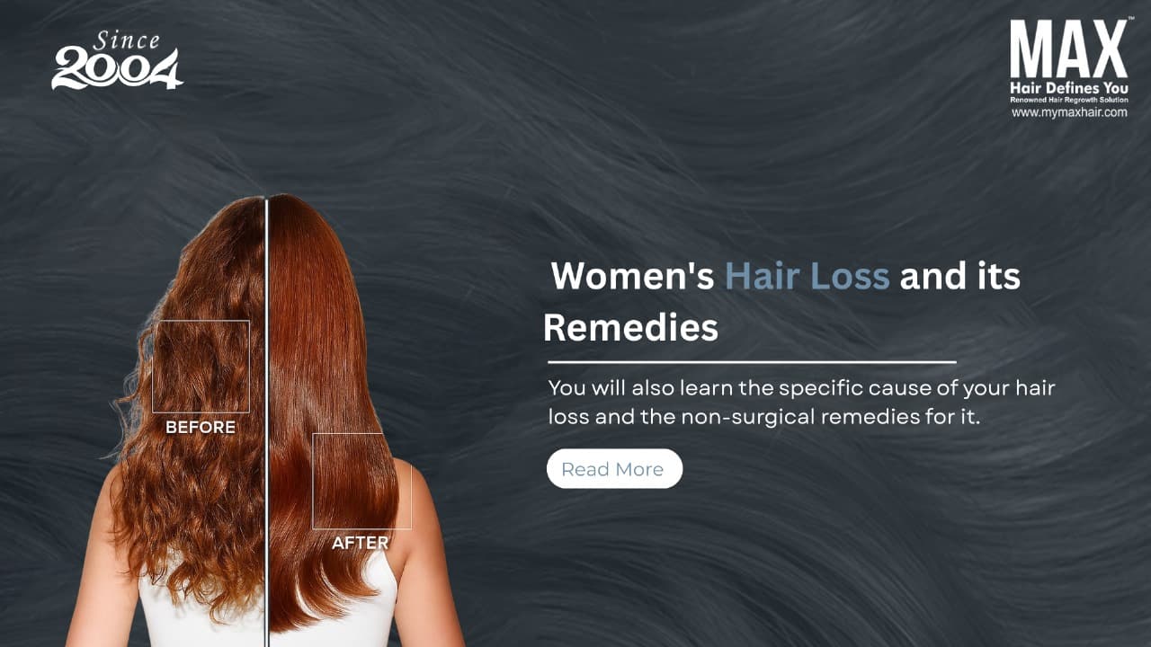 hair Loss  clinic chennai